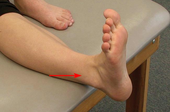 WHAT SHOULD I DO IF I SPRAIN MY ANKLE JOINT?